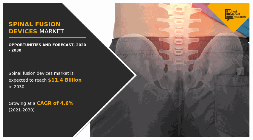 Spinal Fusion Devices Market Size & Growth Forecast - 2030