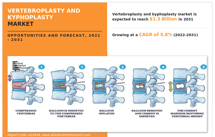 Vertebral compression fracture (VCF): Vertebroplasty and Kyphoplasty